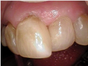 After treatment with Unley dentists