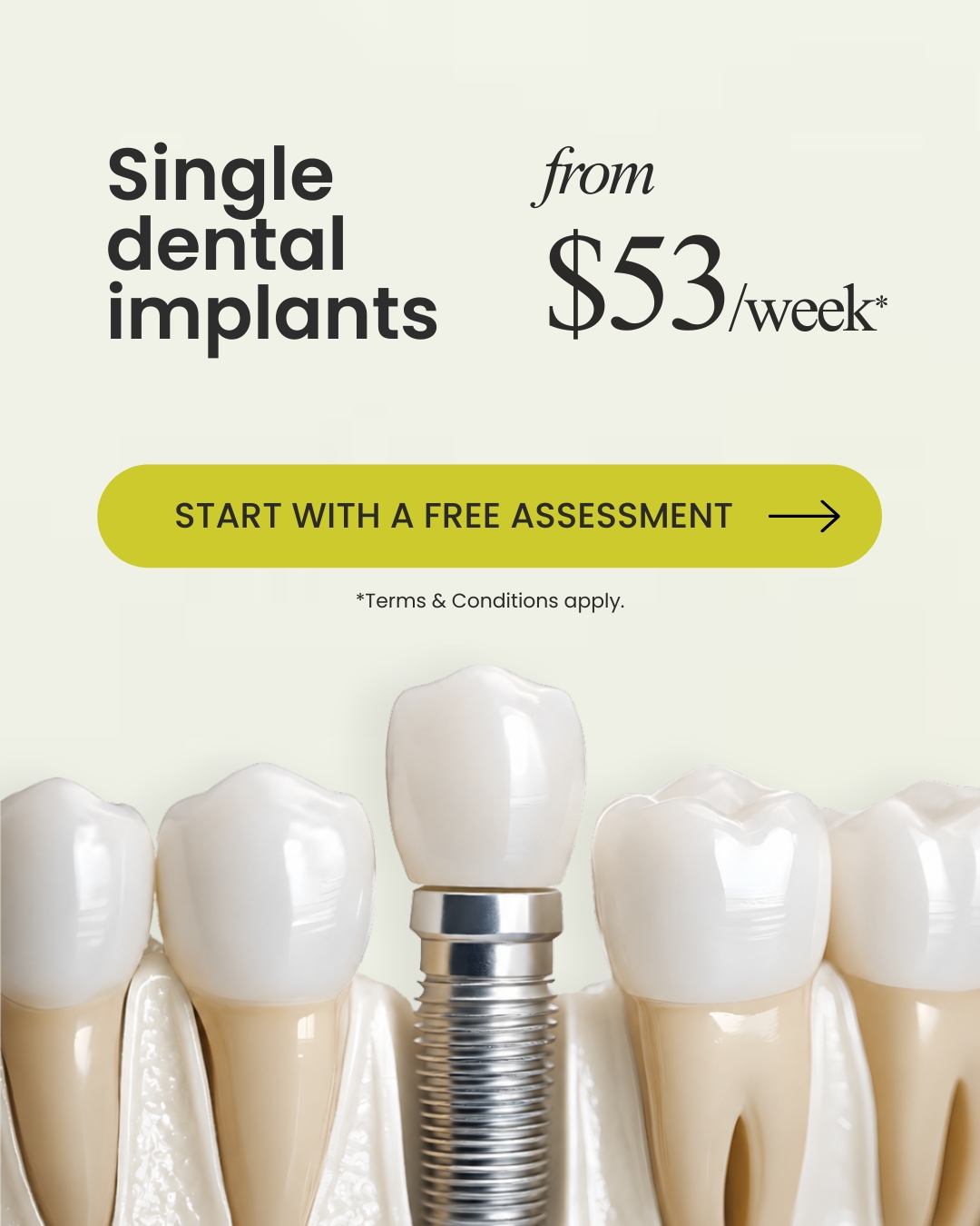 Free Dental Implant Consultation Offer