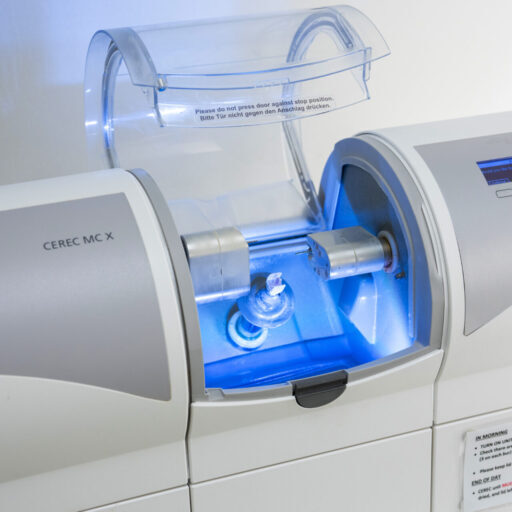 single day cerec crown adelaide - unley dentist