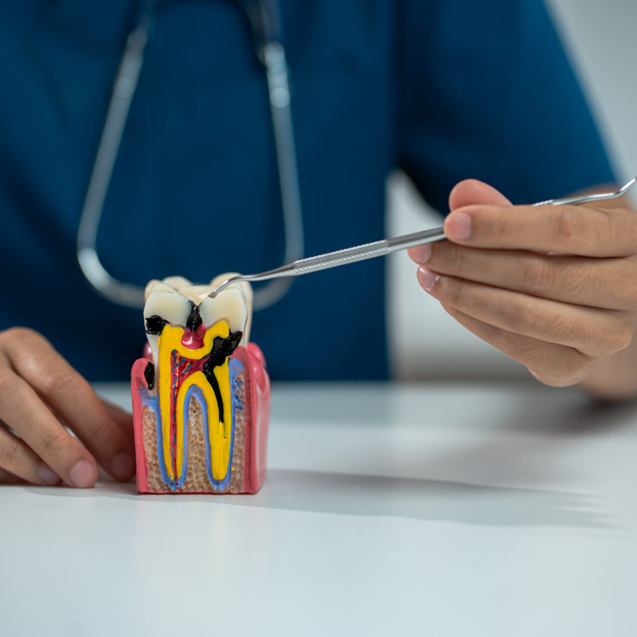 unley dentist explaining root canal treatment in adelaide