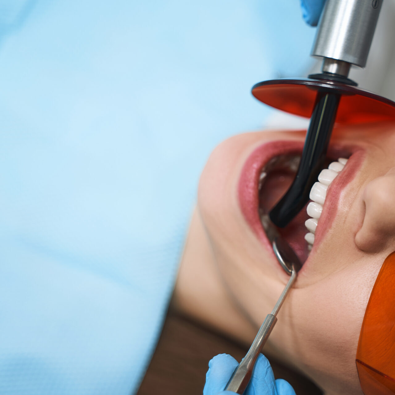 dental filling adelaide procedure with an unley dentist at Dentistry on Unley