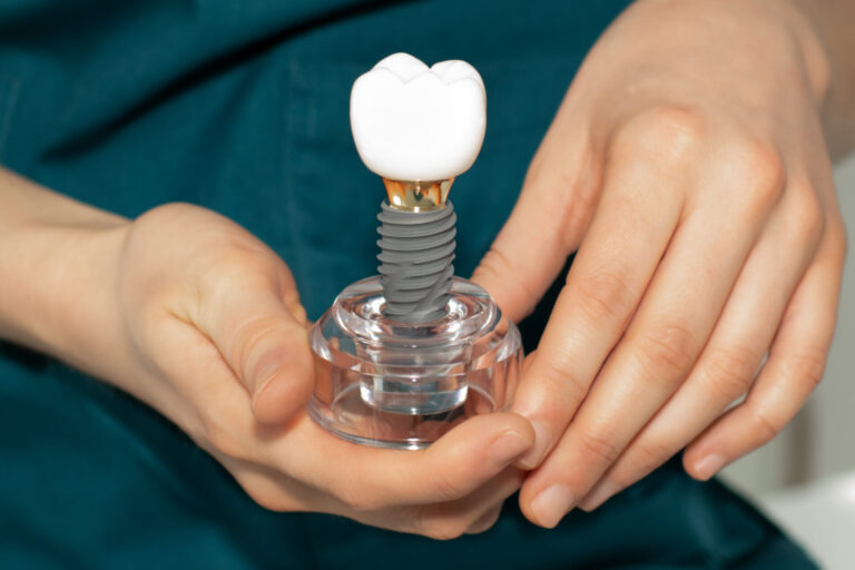implant dentist adelaide holding a dental implant model