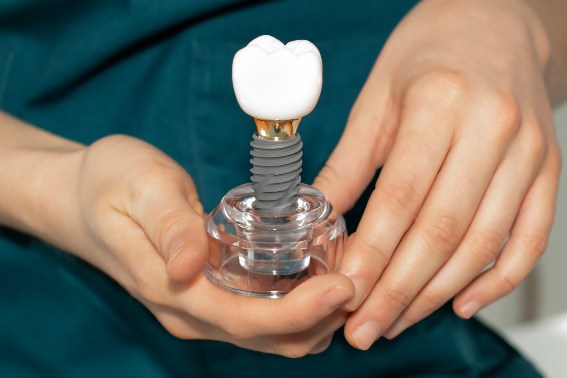 implant dentist adelaide holding a dental implant model